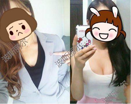 断奶后如何有效丰胸,断奶后如何丰胸又不增肥