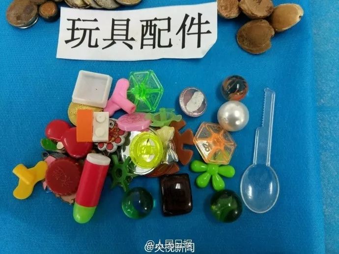3岁女童患怪病肚子大如球,7岁女童突然腹痛元凶竟是畸胎瘤
