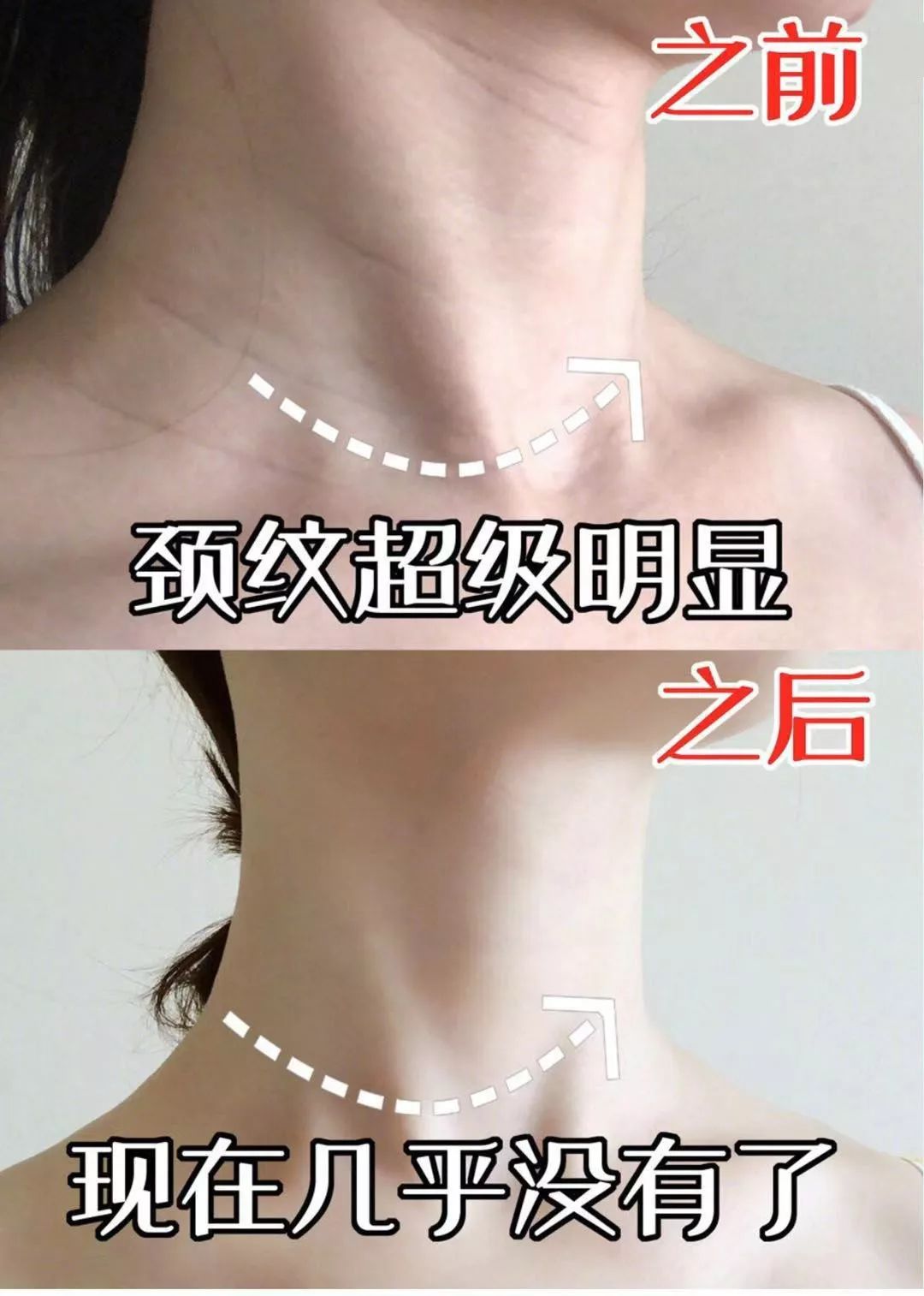 这款急救弹性蛋白贴，每天一片赶走干纹，还你天鹅美颈