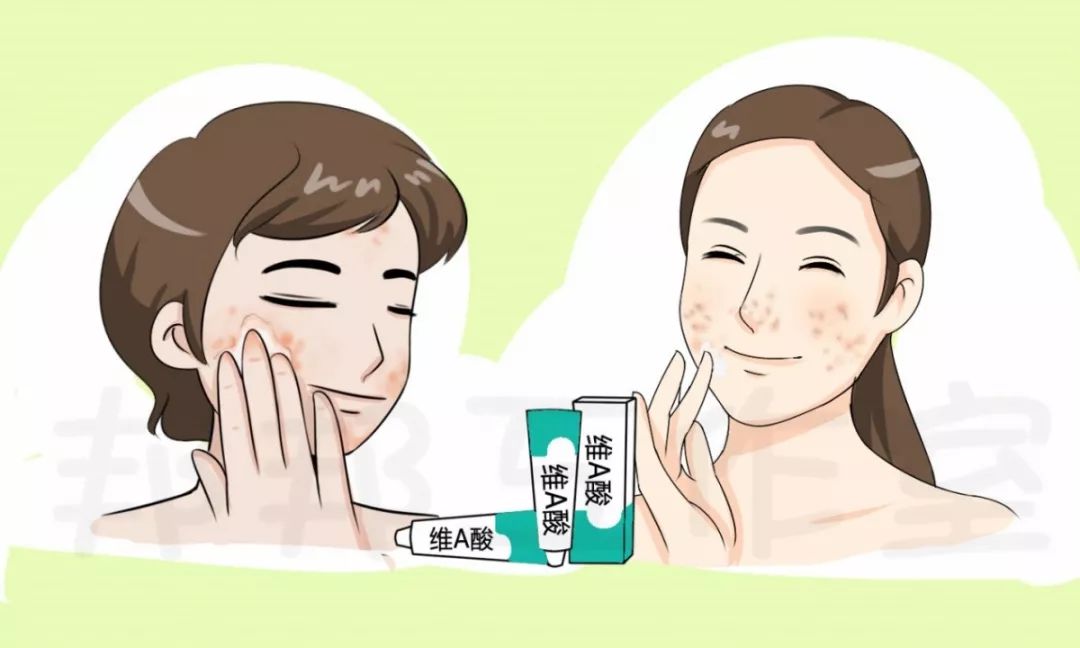 治痘痘维a酸用多少浓度的,使用维a酸爆痘要继续用吗