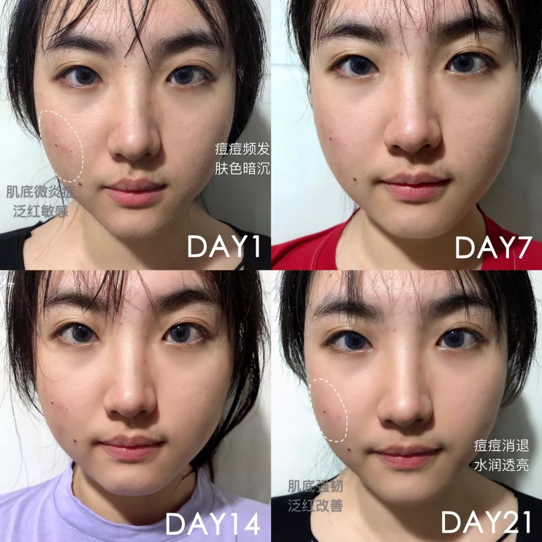 肌诊室修复,肌诊室水光肌挑战