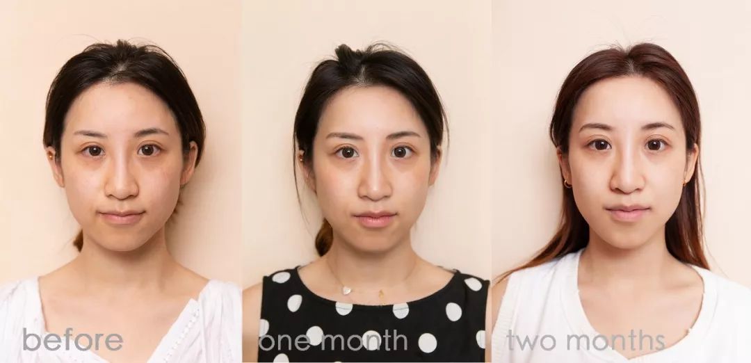 肌诊室修复,肌诊室水光肌挑战