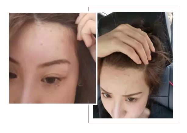 肌诊室水光肌挑战,肌诊室修复