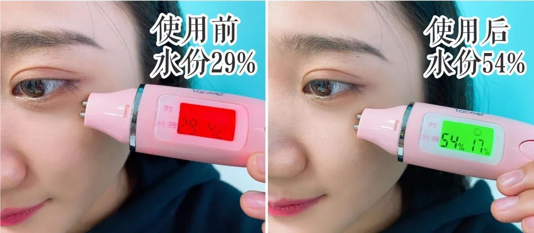 法令纹眼纹一个都逃不掉,法令纹和眼纹怎么才能有效改善