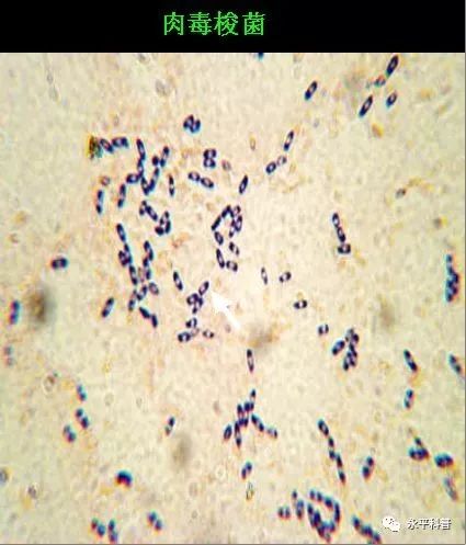 肉毒梭菌食物中毒的防治措施,预防野生菌中毒安全教育文字