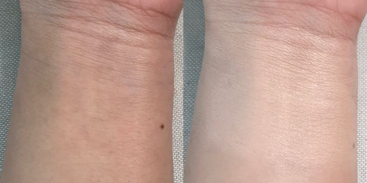 11款热门遮瑕合集,遮瑕笔强力遮斑测评