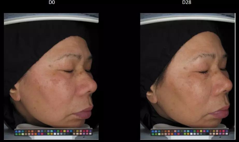 科学合理变白教程,变白最全攻略