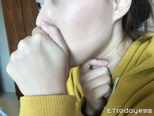 咳黄色浓痰止咳化痰,止咳化痰有浓鼻涕喝什么药