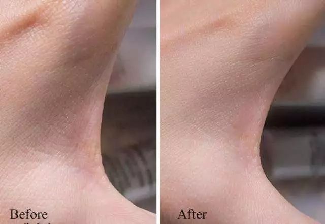 不要让你暴露你的年龄,别让皮肤暴露了你的年龄