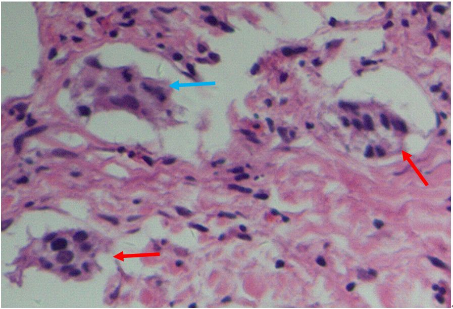 alp和ggt偏高是什么意思,alp和ggt下降意味着什么