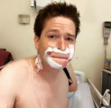 男子被恙虫咬致器官衰竭,男子惨遭蟒蛇吃掉险丧命