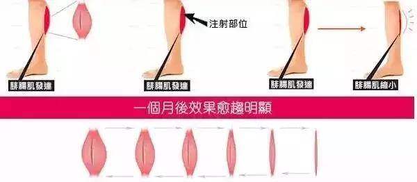 瘦腿小妙招2天见效视频,坐着也能瘦腿的瘦腿秘籍