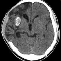 神经影像,神经影像解剖图