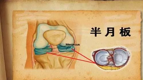 「骨科康复」有关半月板的十个问题，给你最详细的解答