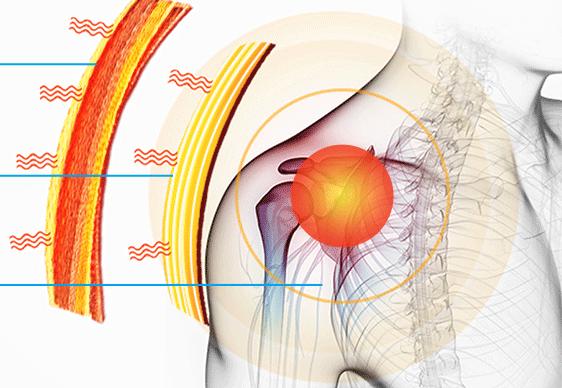 一招改善肩部疼痛,4个方法缓解肩周疼痛