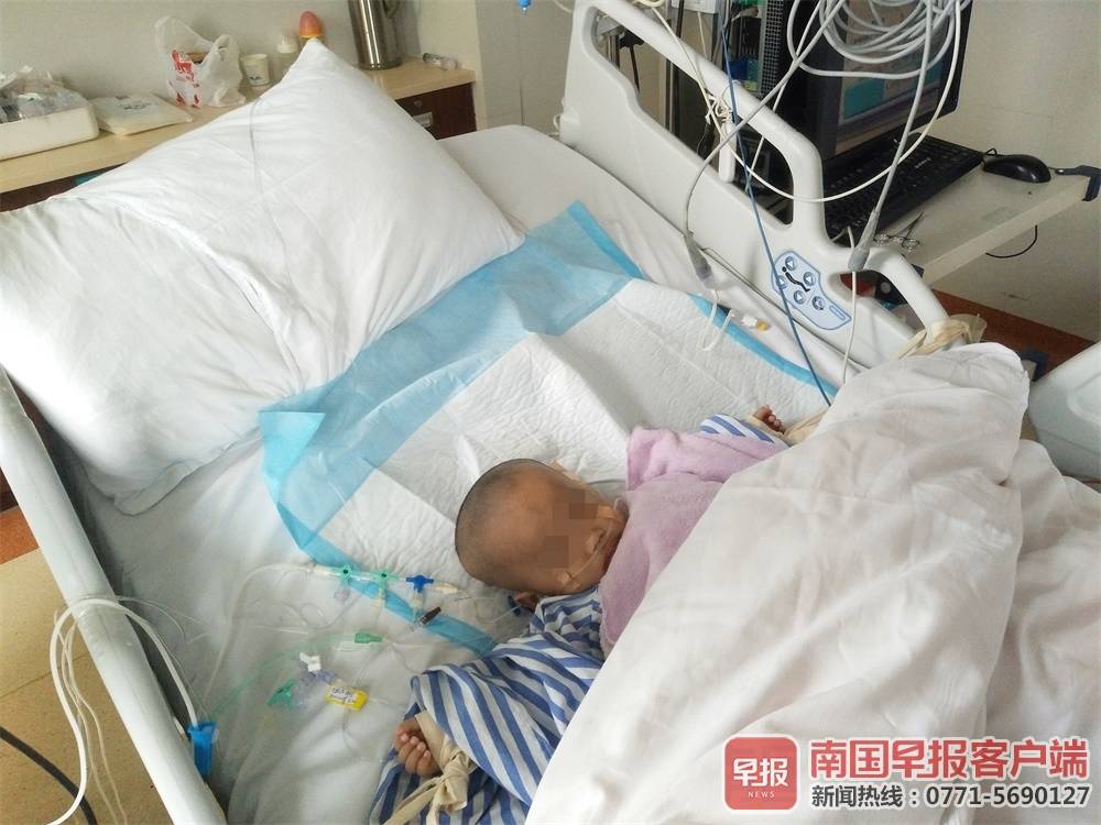 梧州一男婴患怪病腹泻，母亲决然割1.8米小肠救子