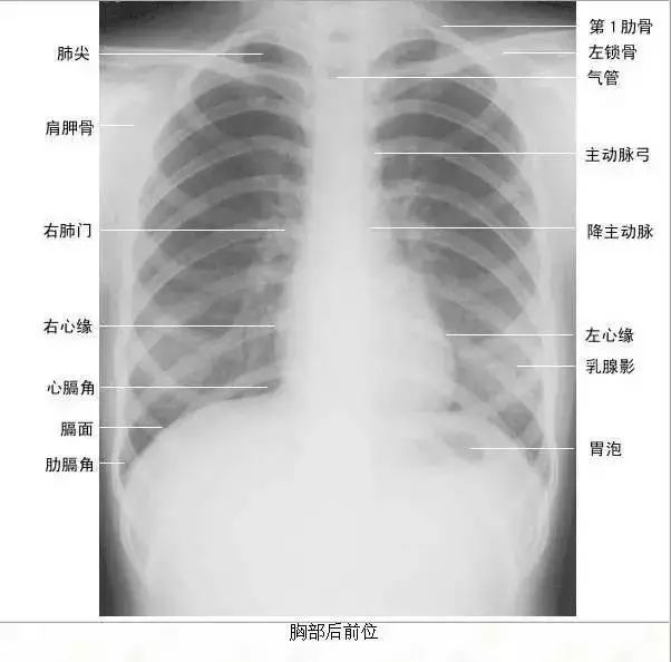 足正常x线解剖图解,常规x线影像解剖图怎么看