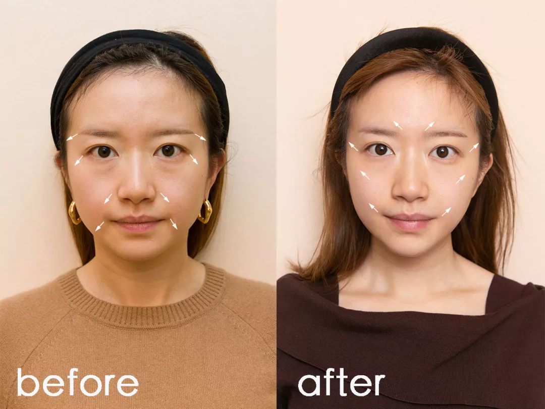 抗老三部曲紧致少女肌,抗老做好这五步hold住童颜少女肌