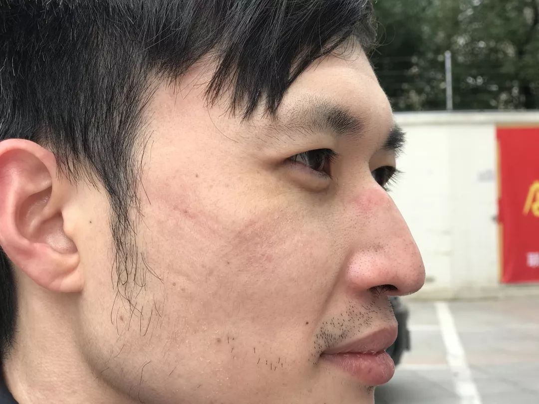 武汉重症医生人数,医护人员重症患者