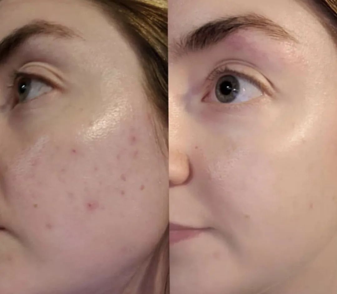 不用海淘的东西,海淘小众护肤品推荐