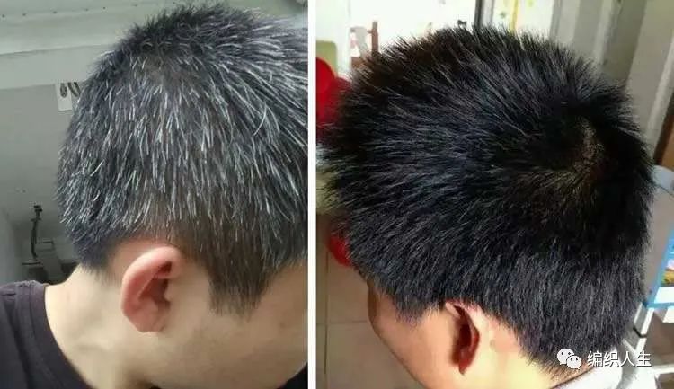 德国老太太用什么洗发水,93岁德国老太太