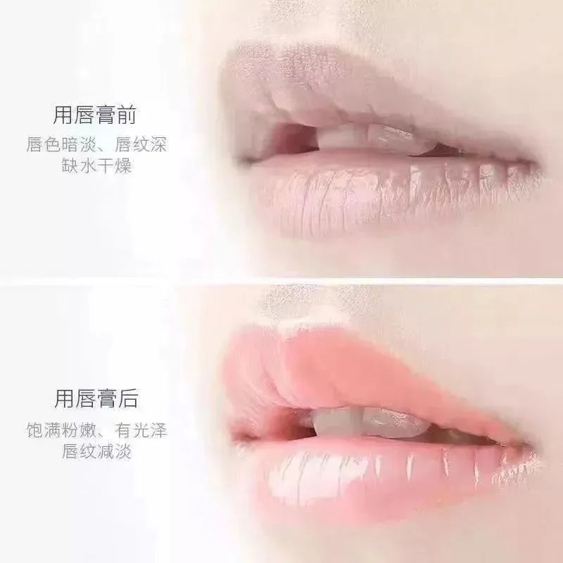 嘴唇干裂起皮等皮掉了涂唇膏,嘴唇干脱皮用什么唇部护理比较好?