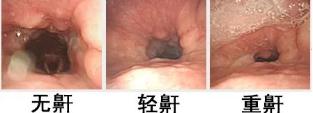 老公呼噜声让我彻夜难眠,老公呼噜声震天响