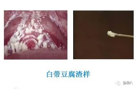 复习这些名解时总觉得怪饿的|协和八·脑洞大开