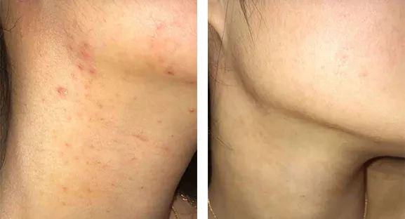 祛湿消肿红豆薏米丸,胡庆余堂薏米