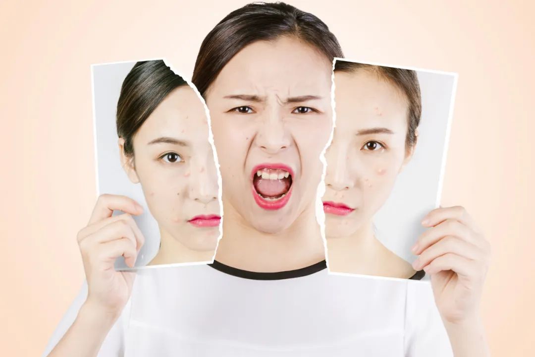 疮上有小泡很痒,疮长脓了抹什么药