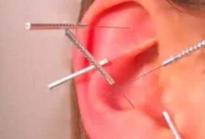 青少年自己得了椎间盘突出很担忧,二十岁就椎间盘突出