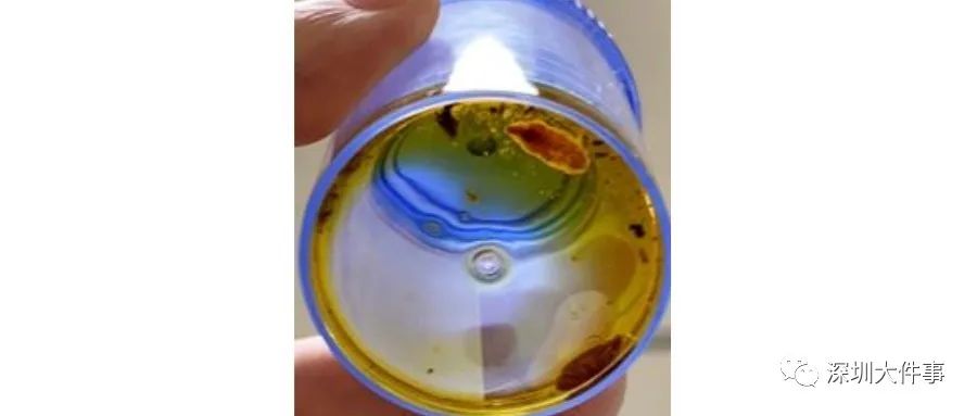 体内驱虫致癌案例,女子体内取出活虫原来吃了这道菜