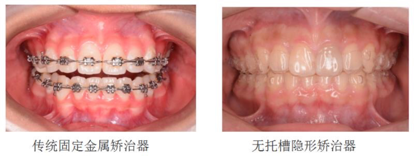 上海儿童康复中心口腔科,儿童口腔医院服务