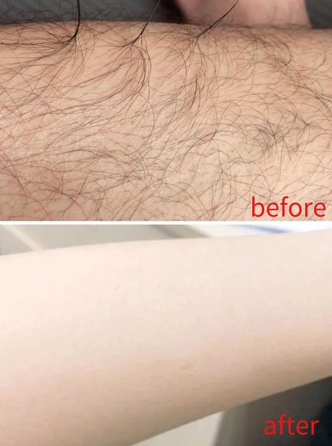 光滑无暇|黑丑的“毛裤腿”，用它，10分钟“脱”得一干二净，肌肤光滑细腻