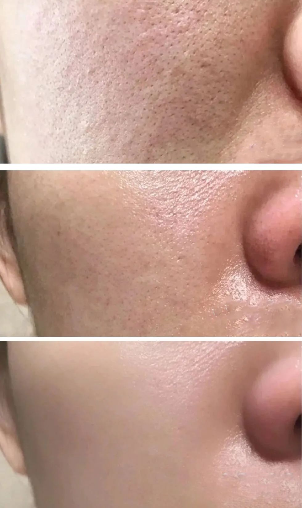 洗出脸上的脏东西解压,清除脸上斑块的产品