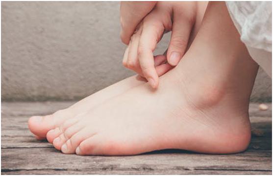 湿疹汗疱疹要注意什么,夏季皮肤湿疹注意事项