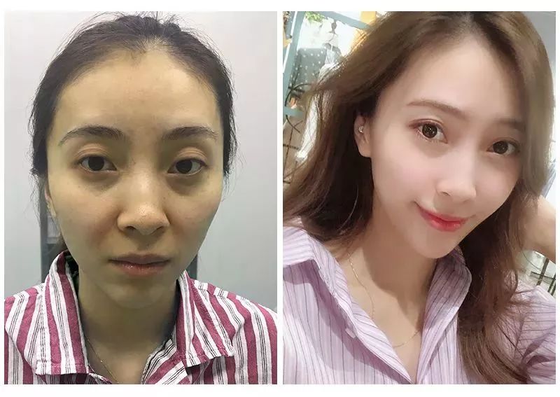 长期补充胶原蛋白的人怎么样了,长期喝胶原蛋白的人最后怎么样了