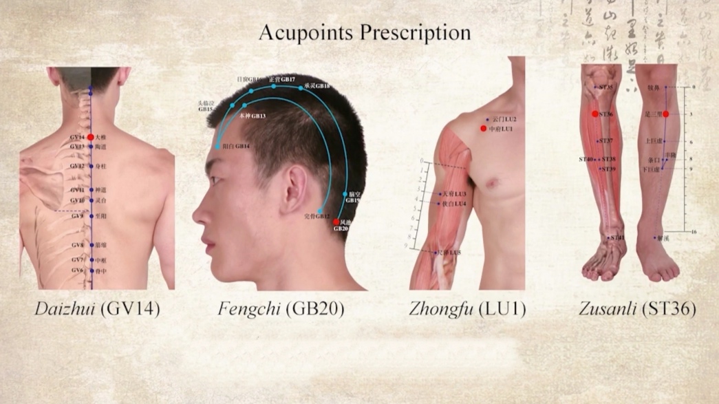 决胜⑤曾芳委员:中医药抗疫法走出国际范儿
