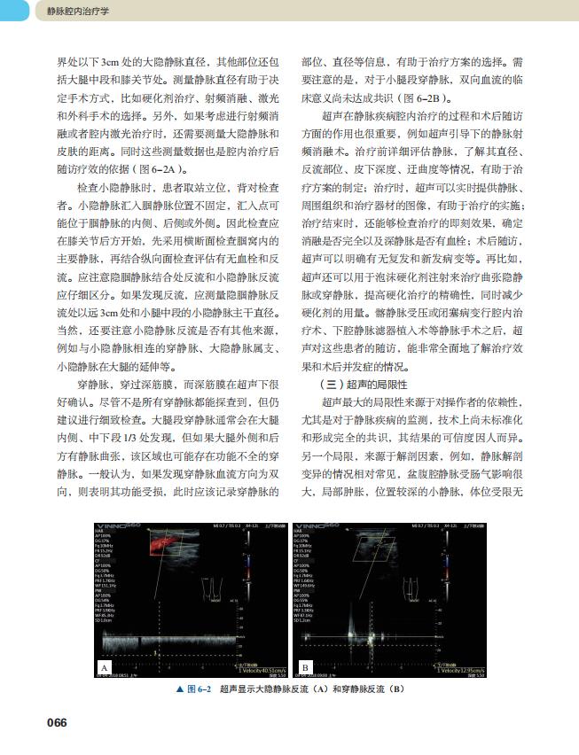 「静脉疾病」年轻化发展怎么办？汪忠镐院士推荐你看这本书