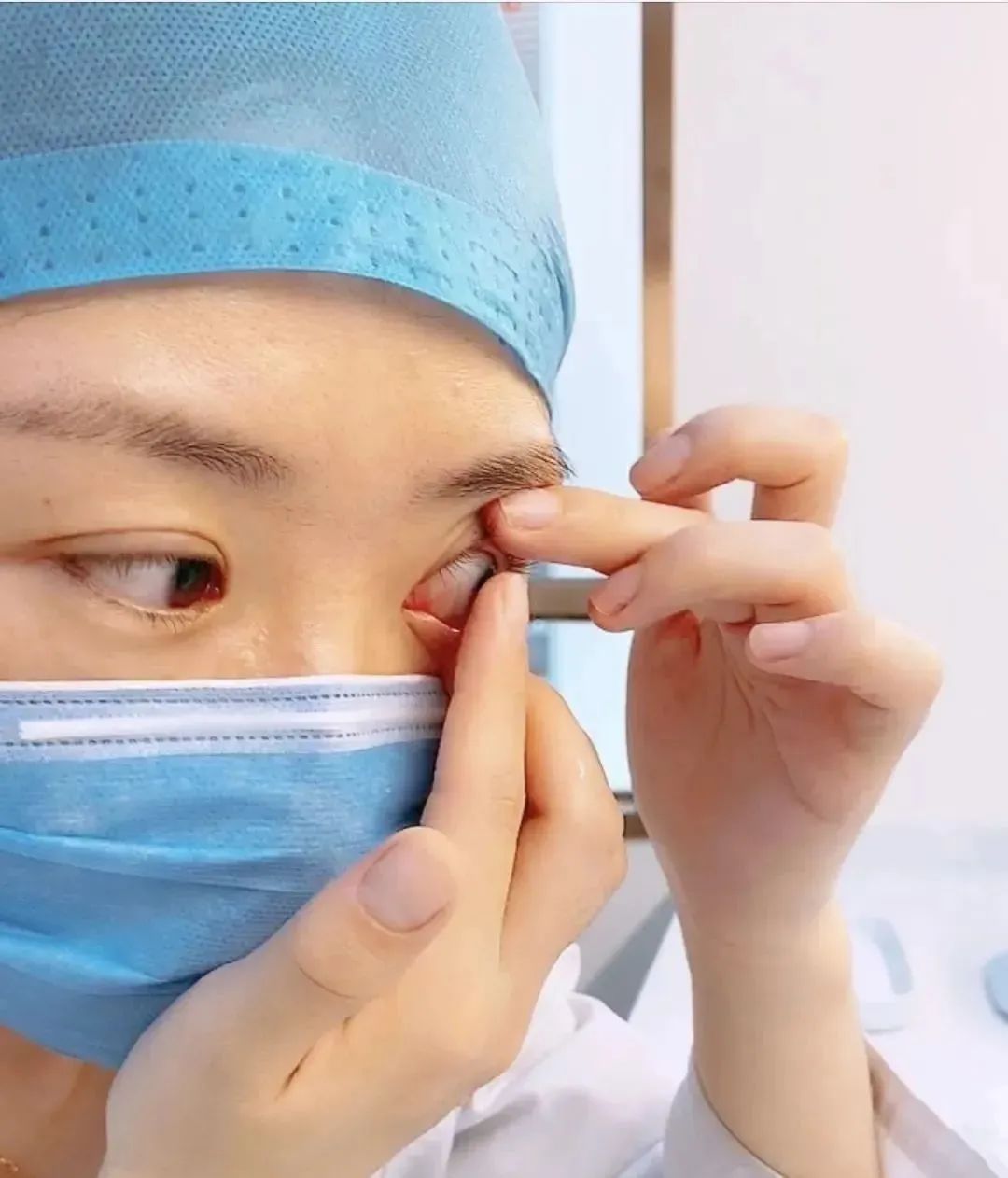 隐形眼镜可以徒手摘吗,摘隐形眼镜有什么好方法吗