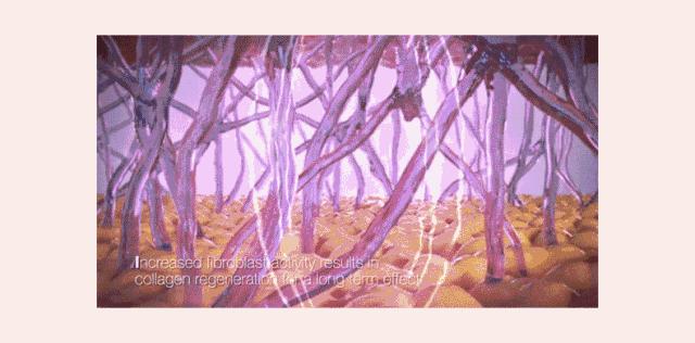 眼角长皱纹了怎么办,长皱纹了怎么办