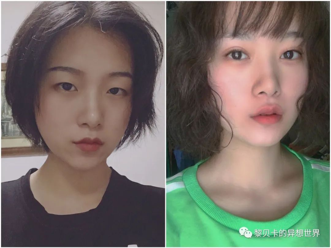 做完医美用可复美吗,你知道做完医美有多可怕