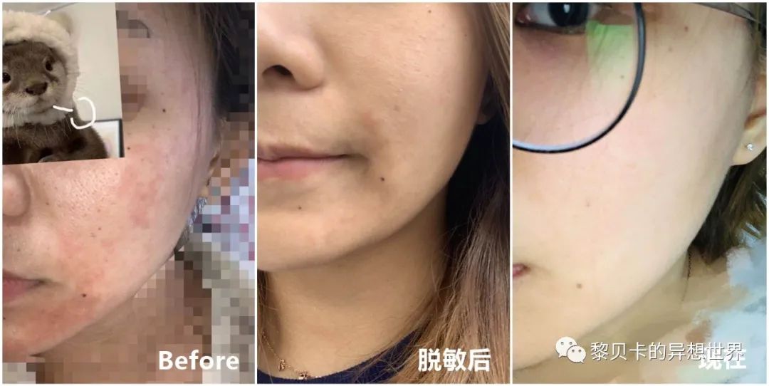 做完医美用可复美吗,你知道做完医美有多可怕