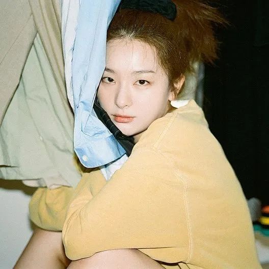 变双眼皮半个月后回到单眼皮,双眼皮怎么临时变成单眼皮