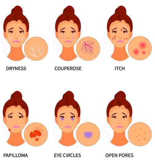 颜值逆袭瘦脸,颜值逆袭瓜子脸