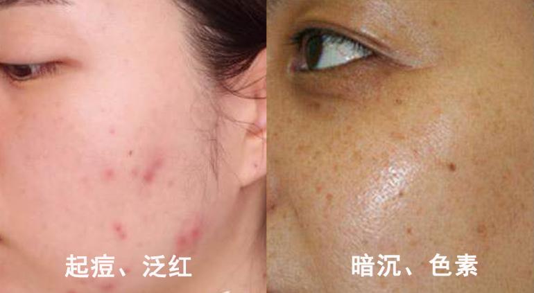 pony娴嬭瘯鐜涗附榛涗匠,pony鍖栧ザ娌瑰