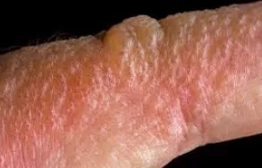 全球最毒的十大毒动物,加拿大最可怕的蛇