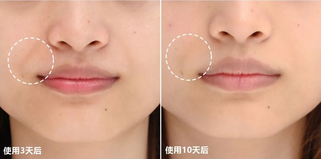 推广｜|下半年想买的第一个大件，我推荐它