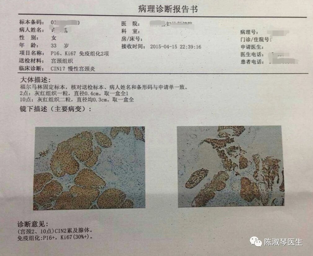 宫颈活检取纱布疼吗,宫颈活检后肚子隐隐疼正常吗