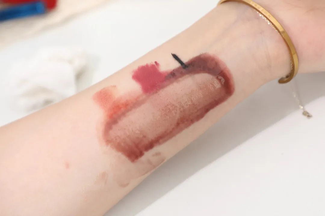 皮肤问题要去专门的皮肤医院吗,各种皮肤问题去哪个医院